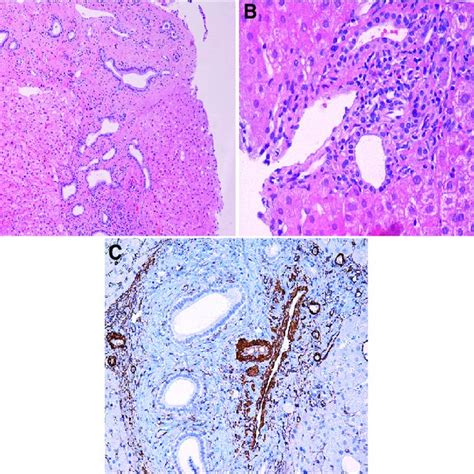 Anatomopathological Examination A The Hematoxy Lin Eosin Staining