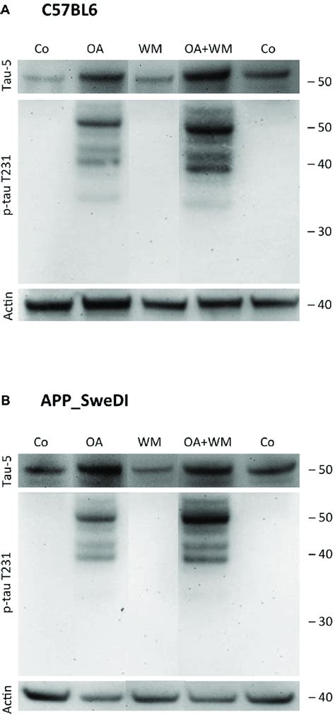 Western Blot For P Tau T231 Brain Slices Of Adult Wt Mice A Or Tg