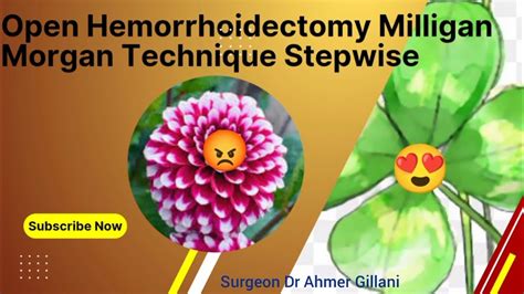 Open Hemmorhoidectomy Milligan Morgan Procedure Stepwise YouTube