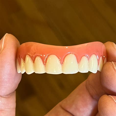 My Instant Veneers™ Upper Only