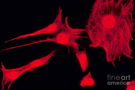 Human Fibroblasts Photograph By David M Phillips Fine Art America