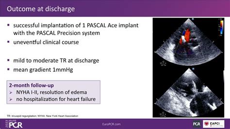 Tailoring Tricuspid Regurgitation Patient Treatment With The Pascal