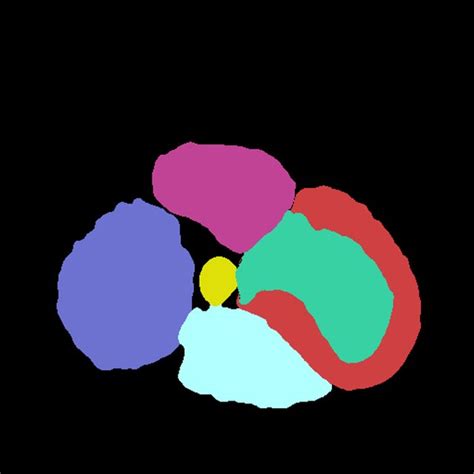 Cardiac Computed Tomography Image Manual Segmentation Labels Of