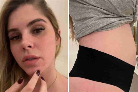 Grávida Bárbara Evans relata espinhas e mostra crescimento da barriga