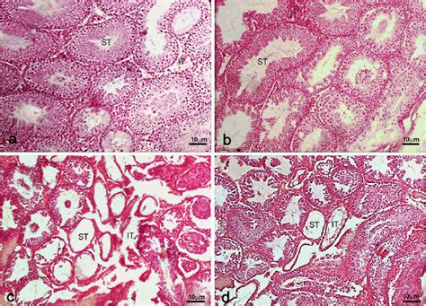 Photomicrograph Of The Testis Stained With Hande × 10 A Control Group