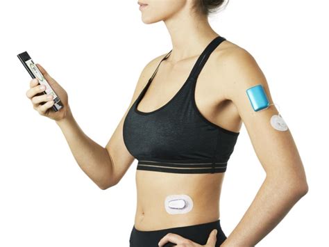 Neues Closed Loop System Zur Therapie Des Typ 1 Diabetes Diabeloop