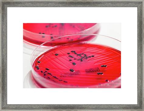 Salmonella On Xld Xylose Lysine Deoxycholate Xld Agar Composition