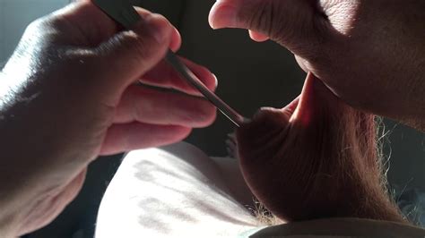 Sunshine Foreskin Five Minute Video Metal Spoon British Gay Sex Toy Porn XHamster