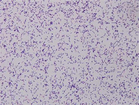 Erysipelothrix Rhusiopathiae Gram Stain Gram Stain Of Erys Flickr