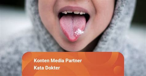 Kanker Lidah Gejala Penyebab Dan Cara Mengobati
