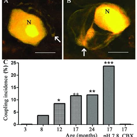 Confocal Microscope Images Of Ly Injected Neurons In Mouse Drgs A A