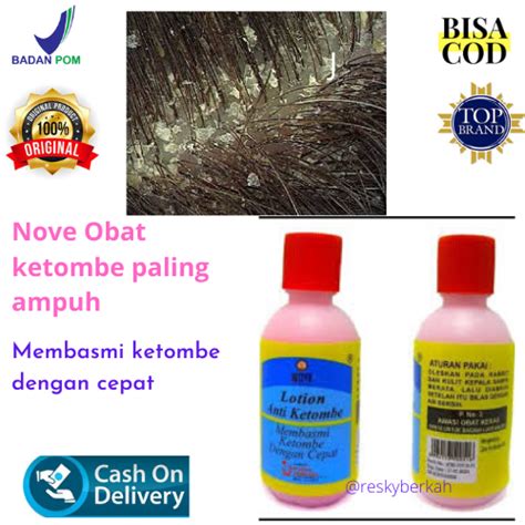 Obat Ketombe Paling Ampuh - Nove Pembasmi Ketombe - Obat Ketombe Nove - Obat anti ketombe ...