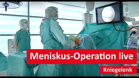 Kniegelenk Meniskus Operation Live Youtube