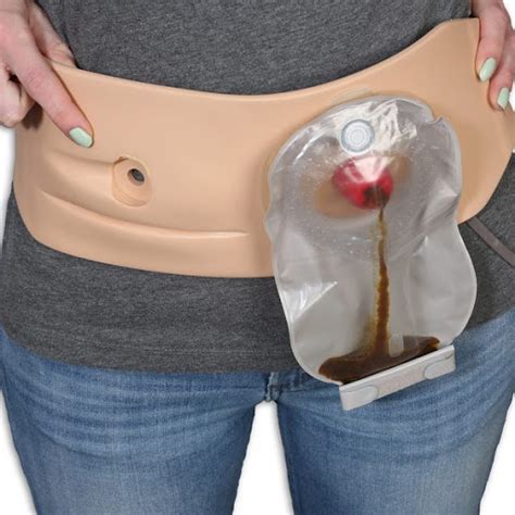 Life After Stoma Surgery Has Your Ostomy Bag Been Limiting You