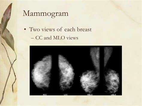 Ppt Screening Mammography Regret Or No Regret Powerpoint