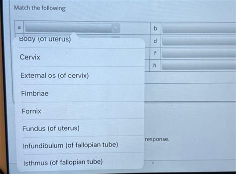 Solved Match the following: | Chegg.com 