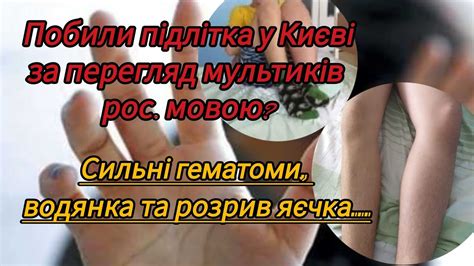 У Києві однолітки жорстоко побили хлопця: вдарили в пах, спричинивши ...