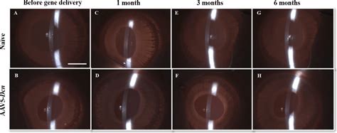 Representative In Vivo Slit Lamp Images Revealing The Optical Sections