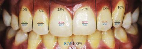 The Methodological Assessment Of Golden Percentage Between The Widths