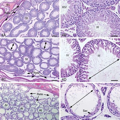 Rete Testis Histology