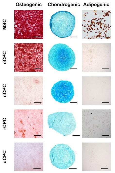 Tri Lineage Differentiation Of The Mscs And Cpcs Using Osteogenic