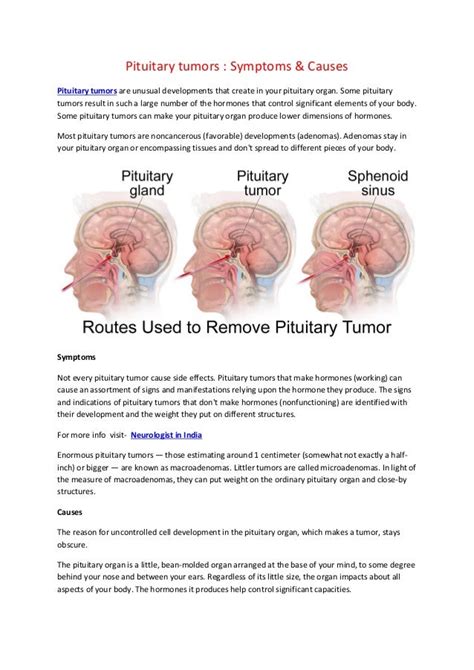 Pituitary tumors symptoms & causes