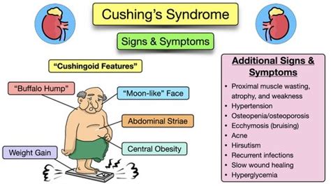 Cushing S Syndrome Symptoms Causes Treatment Diagnosis Definitions Adrenal Gland — Ezmed