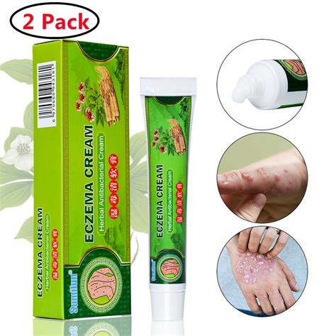 2 Pack Eczema Cream Dry Skin Eczema Treatment Calendula Cream