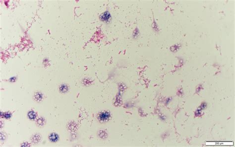 Salmonella Enterica Serovar Paratyphi Gram Stain