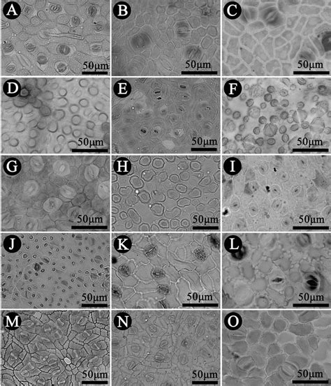 Leaf Epidermis Of Lauraceae Under Light Microscope A Machilus Download Scientific Diagram