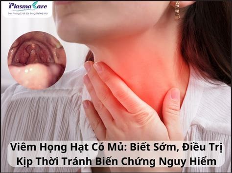 Viêm Họng Hạt Có Mủ Biết Sớm Điều Trị Kịp Thời Tránh Biến Chứng Nguy