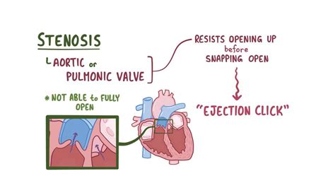 Abnormal heart sounds: Video, Anatomy & Definition | Osmosis