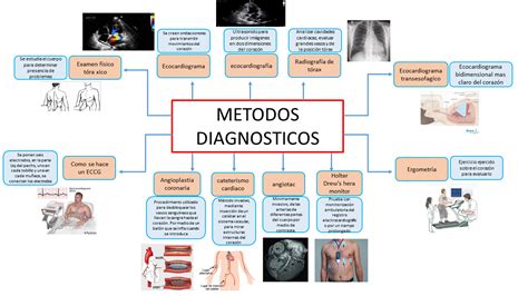 M Todos Diagn Sticos Fundamentos Quir Rgicos Cirug A Cardiovascular