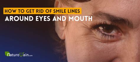 How To Get Rid Of Smile Lines Around Eyes And Mouth [naturally]