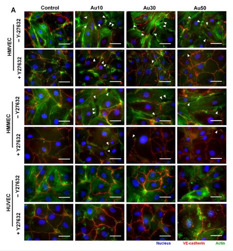 Pdf Overview Of Mechanism And Consequences Of Endothelial Leakiness