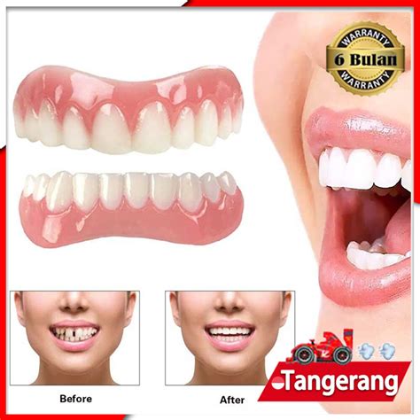 Jual Gigi Palsu Instan Perfect Smile Veneer Gigi Tiruan Instan Atas