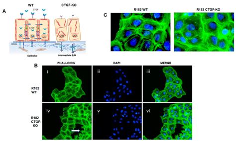 Loss Of CTGF Promotes Extracellular Matrix Remodeling A Proposed