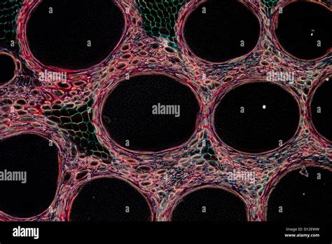 Microscopy Micrograph Plant Tissue Stock Photos And Microscopy Micrograph
