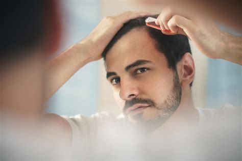 Maintaining Stem Cell Stickiness Could Be The Key To Battling Baldness