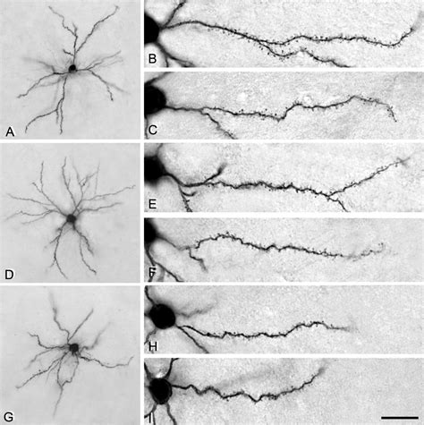 Density And Morphology Of Dendritic Spines In Mouse Neocortex