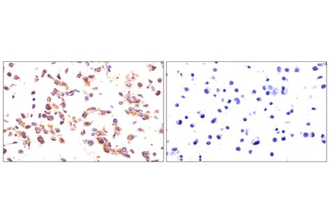 Axl E3z2h Rabbit Mab Cell Signaling Technology