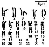 3. Karyotype showing the 23 pairs of human chromosomes. | Download ...