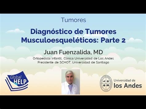 Diagn Stico De Tumores Musculoesquel Ticos Parte Youtube