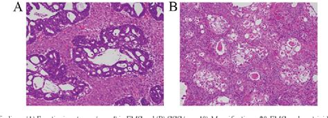 Figure 1 From Molecular Association Of Functioning Stroma With