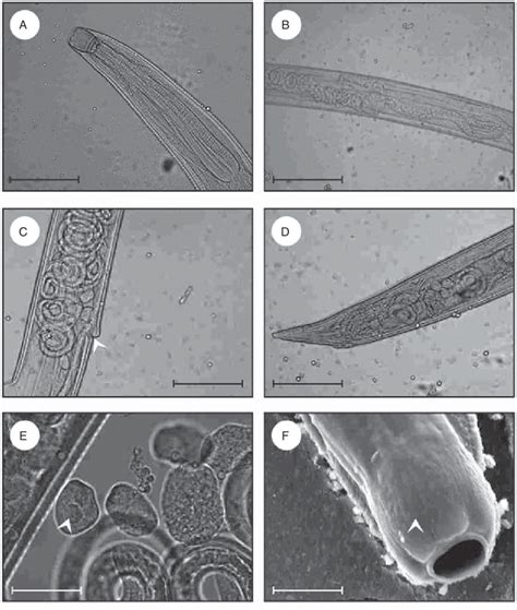 Procamallanus Laevionchus Photomicro Graphs Of Female Specimen A