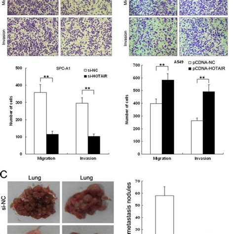 Effect Of Hotair On Cell Migration Invasion And Metastasis A B