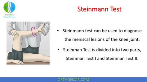 Steinman Test • What For • Easy Explained Orthofixar 2025