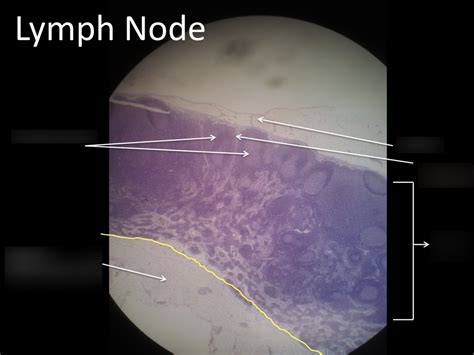 Lymph Node Histology Diagram Quizlet