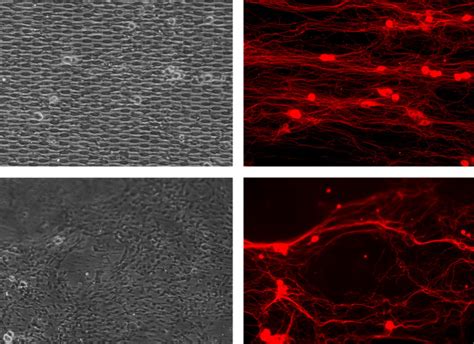 A Tangle Of Talents Untangles Neurons