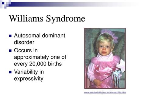 Ppt Williams Syndrome Powerpoint Presentation Id 297197